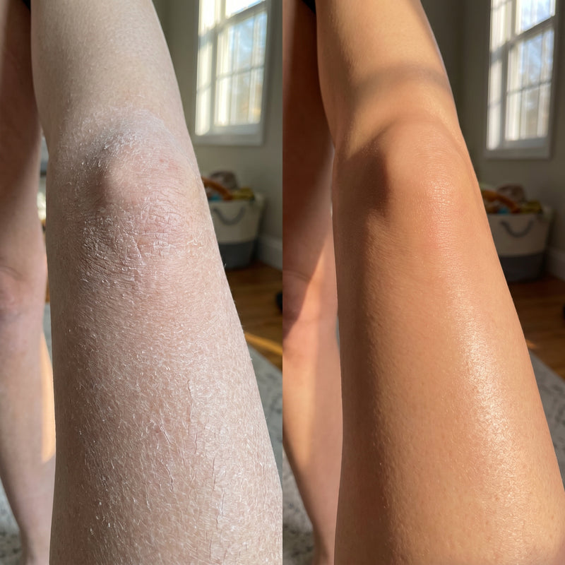 Before and after results for Olivia P.
