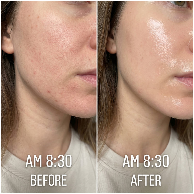 Before and after results for Karen