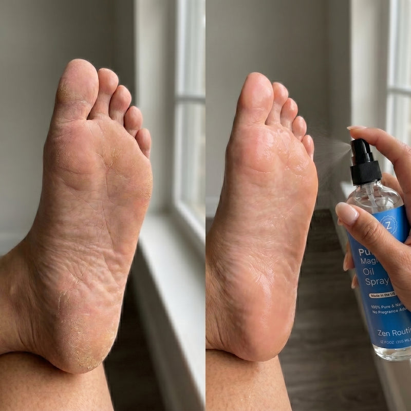 Before and after results for Rachel K.