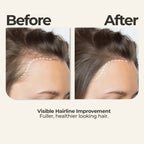 Rosemary Oil + Head Massager (Bundle)