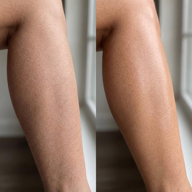 Before and after results for Jessica