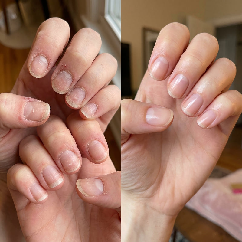 Before and after results for Taylor W.