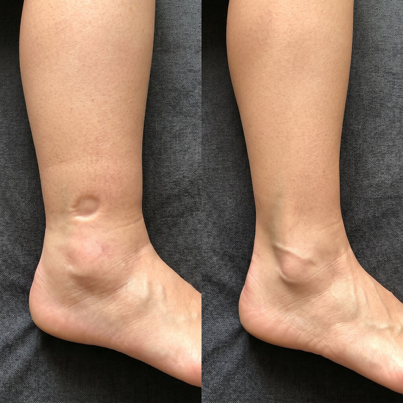 Before and after results for Megan R.